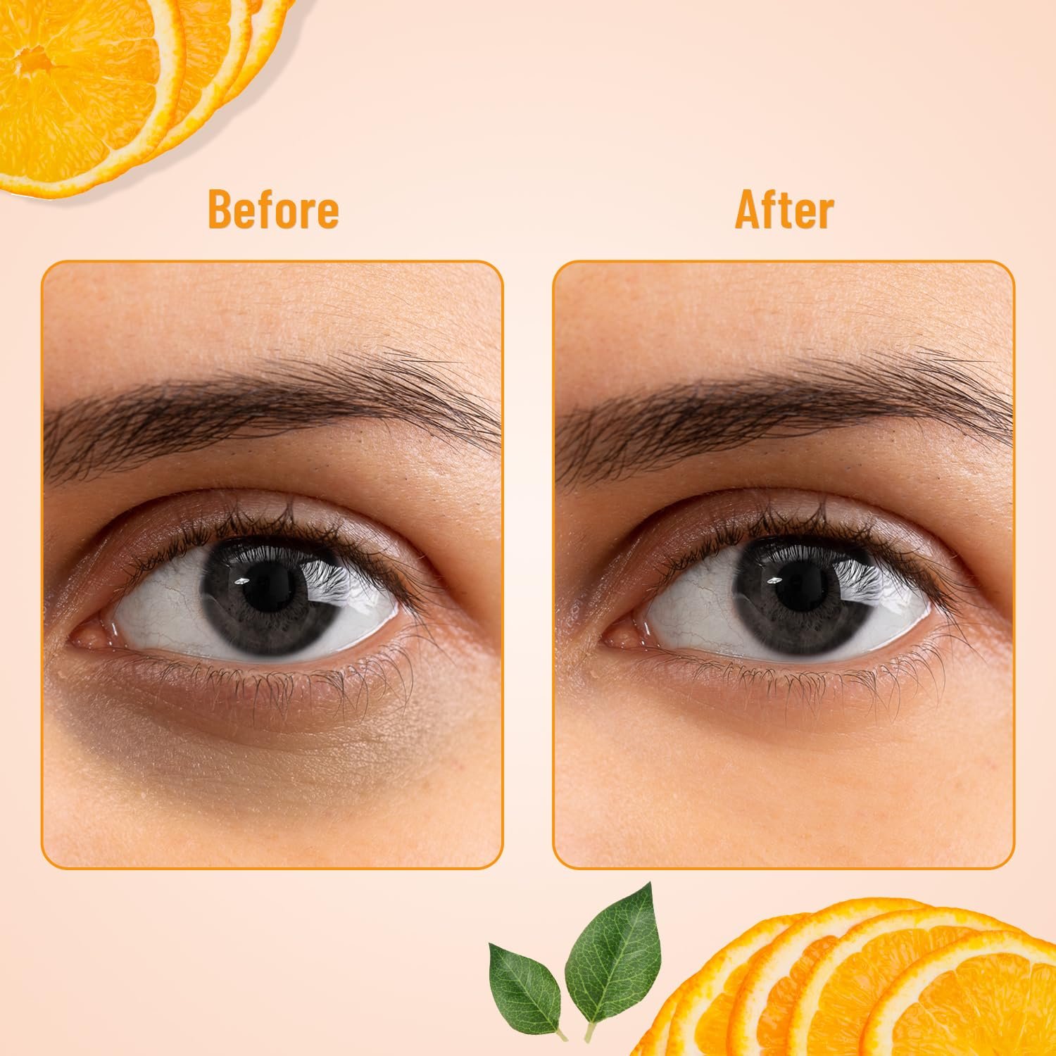 Swiss Beauty Hydra Anti Wrinkle Eye Serum Patch| Treats Dark Circles, Fine Lines And Wrinkles | Enriched With Collagen And Aloe Vera Extract | Shade -Gold, 60 Pcs - Image 7