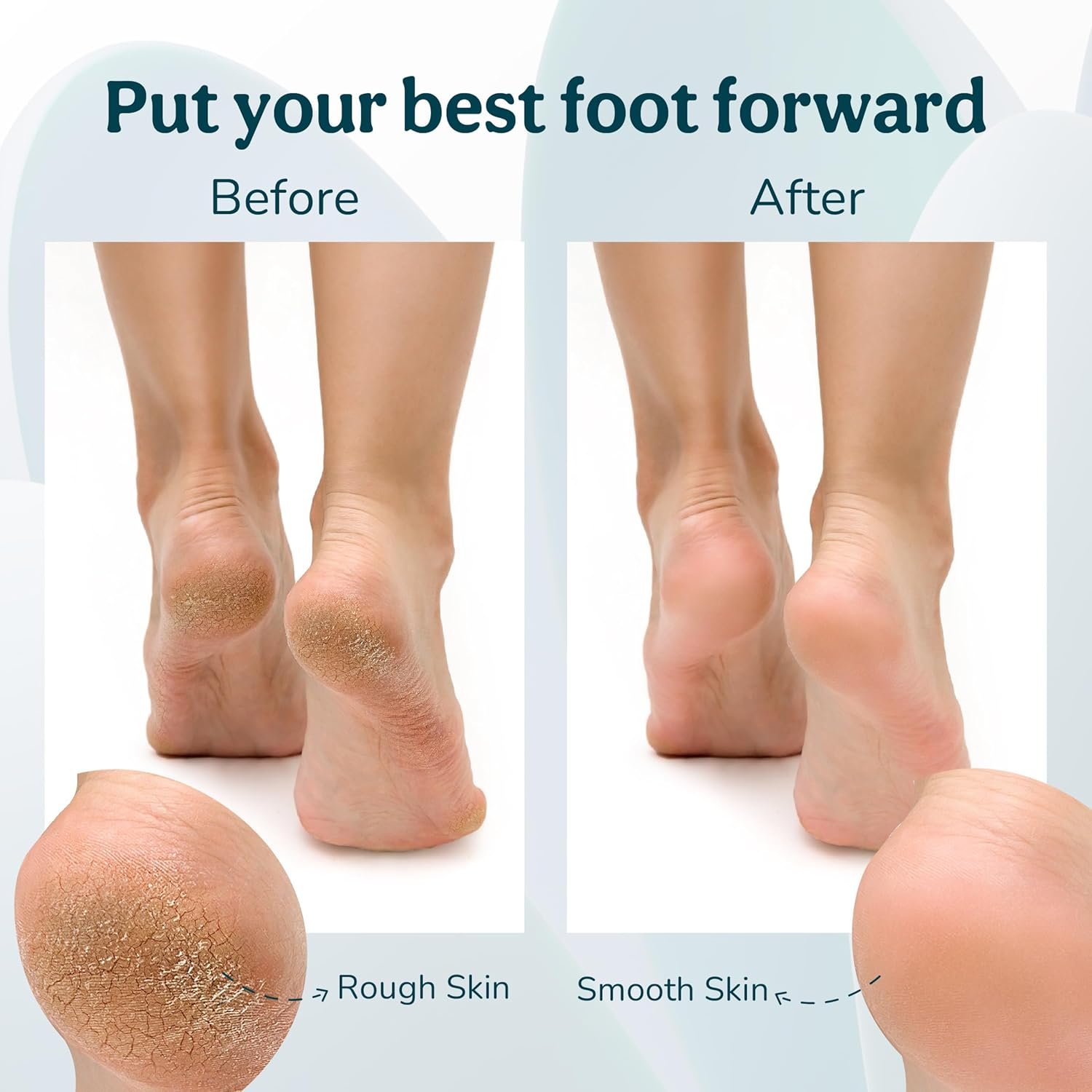 CARESMITH Bloom Callus Remover For Feet Electronic | Foot Scrubber For Dead Skin | 3 Crystal Quartz Heads Suitable For Dead Skin Remover | Pedicure Kit For Women As Foot Cleaner - Image 7